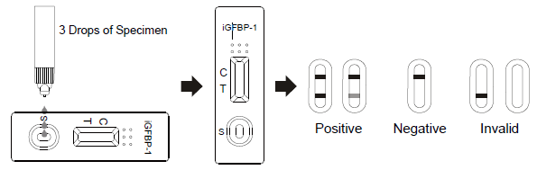 O fluxo lateral Immunochromatographic analisa a gaveta rápida do teste de AllTest iGFBP-1 na descarga Vaginal