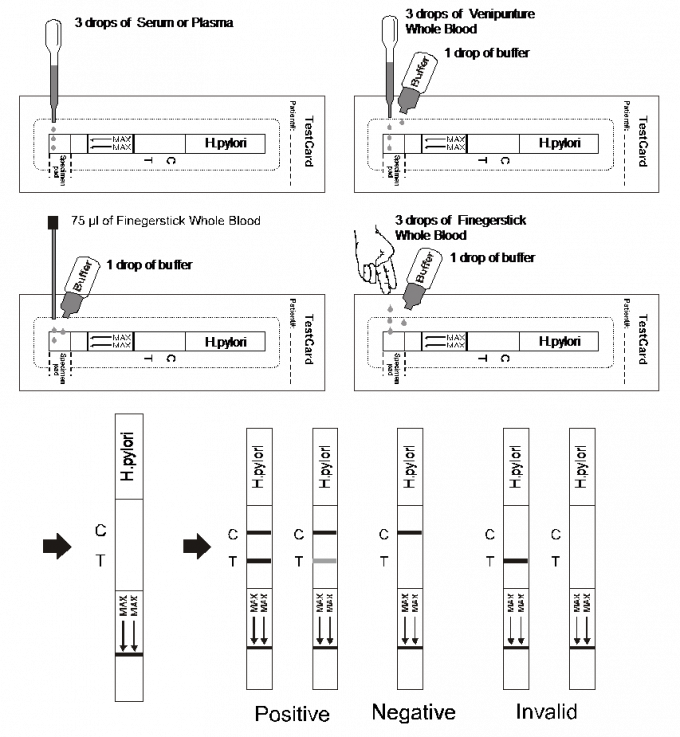 O fluxo lateral Immunochromatographic do anticorpo de H.pylori analisa tiras, sangue inteiro/soro/plasma