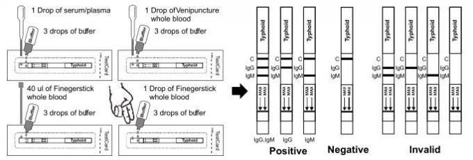 Medidor de óleo rápido tifoide do teste/tiras (sangue inteiro/soro/plasma)