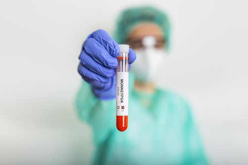 Latest company news about Macaco-pox tomam a rota Covid-19?