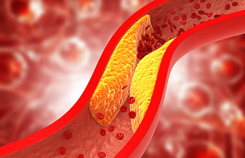 Latest company news about Decodificar o colesterol: seu caminho para um corpo saudável