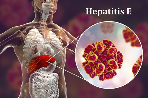 Latest company news about Ameaça viral à reprodução: os perigos ocultos da hepatite E