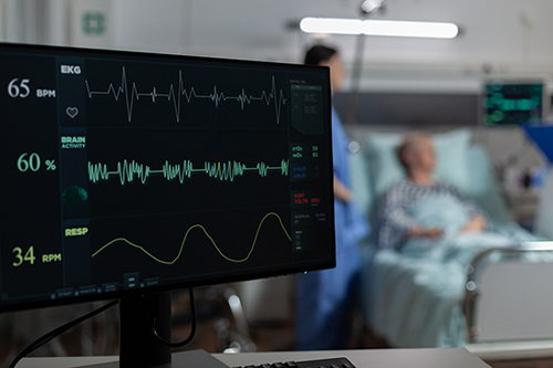 Últimos blogs da empresa sobre Compreender a fibrilação atrial (Fib)